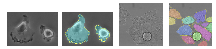 2D image segmentation